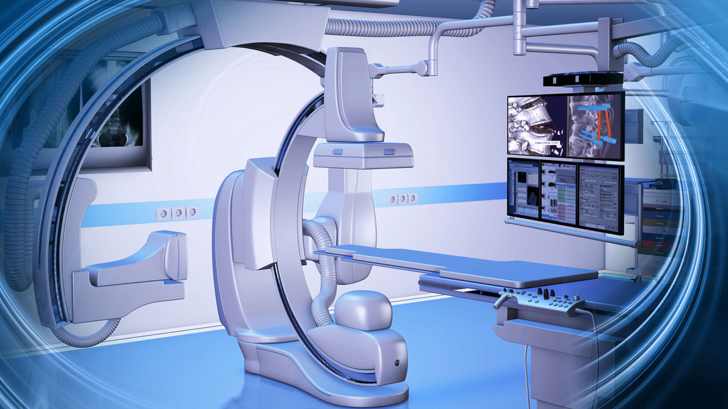 mediCAD in the Operation Room